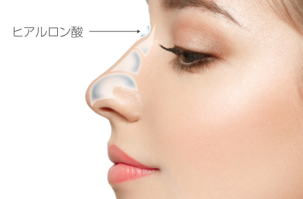 hiyaruronsan