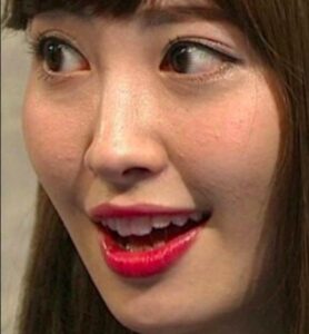 肌の汚さが目立つ女性 男性芸能人２９選 どうしてこんなに肌荒れが多いのか判明 クロの生活日記